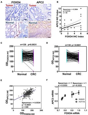 FOXO4 Inhibits the Migration and Metastasis of Colorectal Cancer by Regulating the APC2/β-Catenin Axis